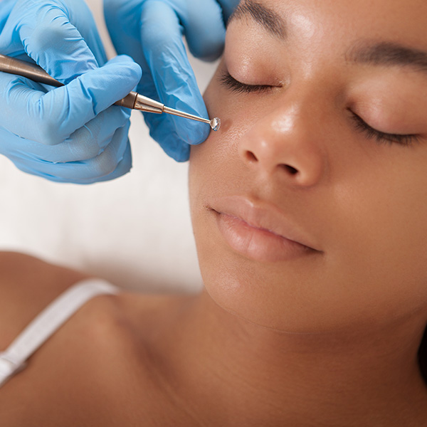 Especialidade dermatologia - Clinica Luzes São Caetano